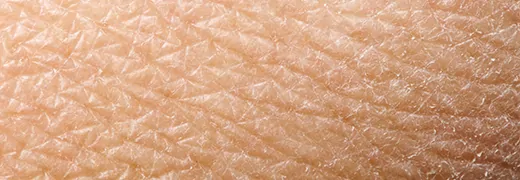 MedicalPoint International Hospital What are the causes of dry skin How can it be treated