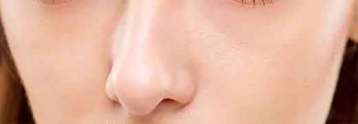 MedicalPoint International Hospital What is Nasal Septal Perforation