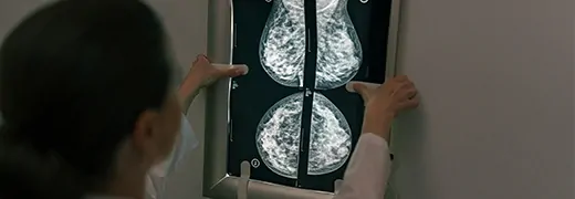 MedicalPoint International Hospital What is a mammogram mammography How is it done